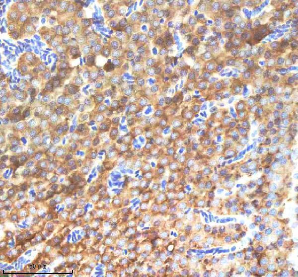  IHC analysis of NANOS3 using anti-NANOS3 antibody (AZQ90WW1)