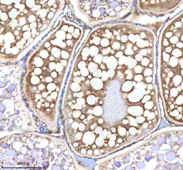  IHC analysis of NANOS3 using anti-NANOS3 antibody (AZQ90WW1)