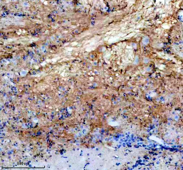 IHC analysis of GNAT1 using anti-GNAT1 antibody (AZQ90WX6)
