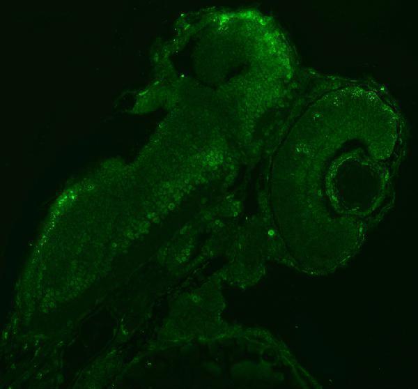 azq90x41 sf3a1 primary antibodies if testing 1