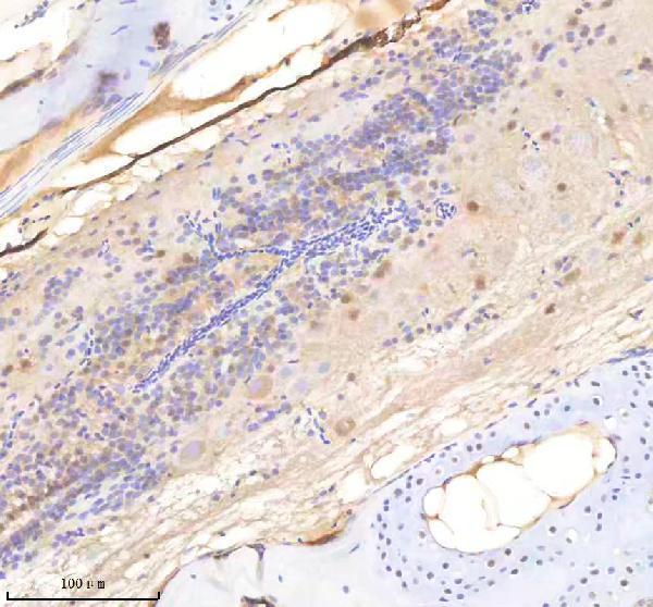 IHC analysis of SF3A1 using anti-SF3A1 antibody (AZQ90X41)