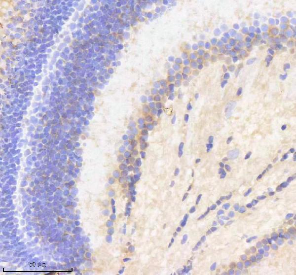 IHC analysis of SF3A1 using anti-SF3A1 antibody (AZQ90X41)