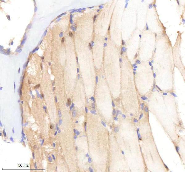 IHC analysis of SF3A1 using anti-SF3A1 antibody (AZQ90X41)