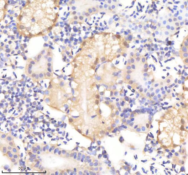 azq90x41 sf3a1 primary antibodies ihc testing 4