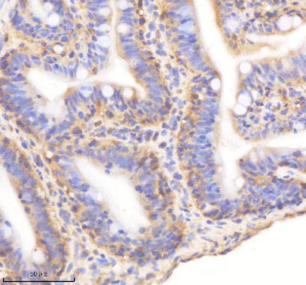 azq90x41 sf3a1 primary antibodies ihc testing 5