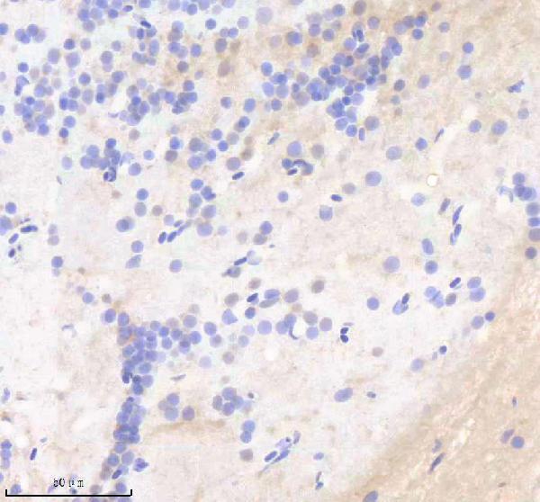 azq90x41 sf3a1 primary antibodies ihc testing 6