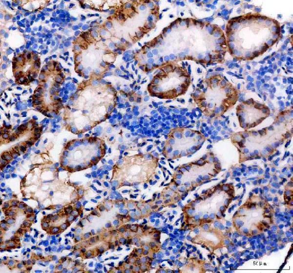 azq90x63 cdh17 primary antibodies ihc testing 1