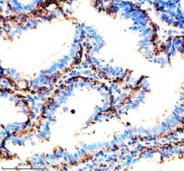 azq90x63 cdh17 primary antibodies ihc testing 2