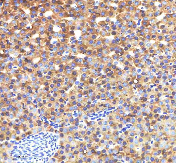  IHC analysis of Lysozyme/LYZ using anti-Lysozyme/LYZ antibody (AZQ90YS5)