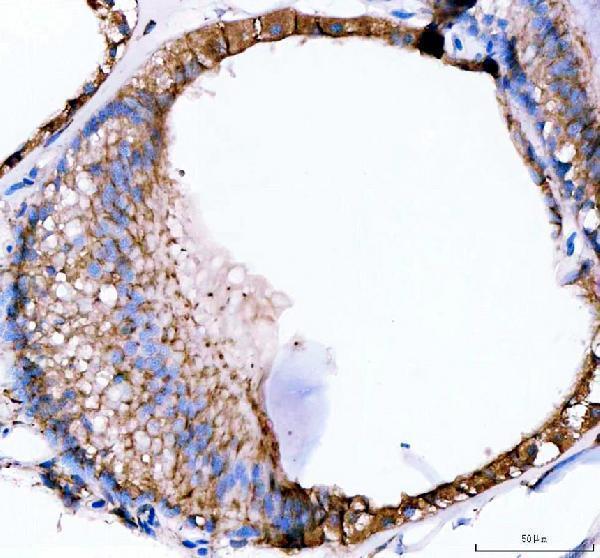  IHC analysis of E-cadherin/CDH1 using anti-E-cadherin/CDH1 antibody (AZQ90Z37)