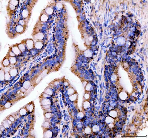  IHC analysis of E-cadherin/CDH1 using anti-E-cadherin/CDH1 antibody (AZQ90Z37)