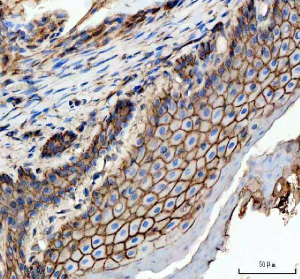 azq90z37 e cadherin cdh1 primary antibodies ihc testing 4