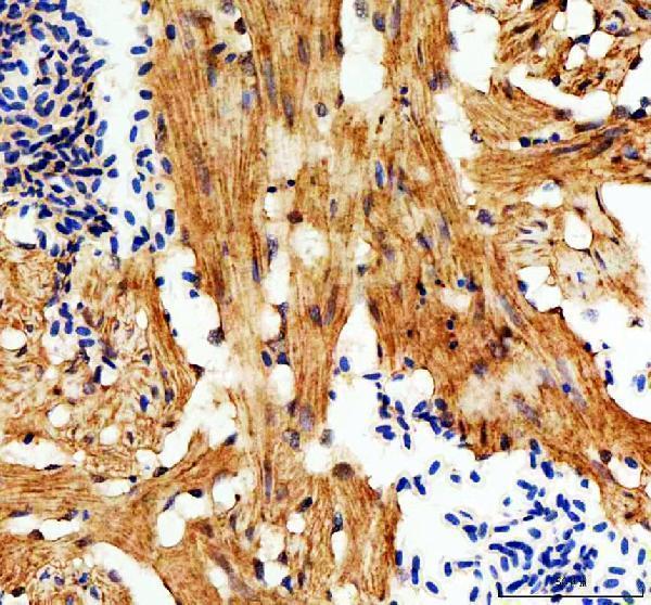 azq90z37 e cadherin cdh1 primary antibodies ihc testing 5