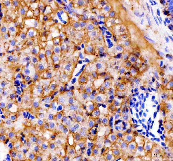 azq90z37 e cadherin cdh1 primary antibodies ihc testing 6