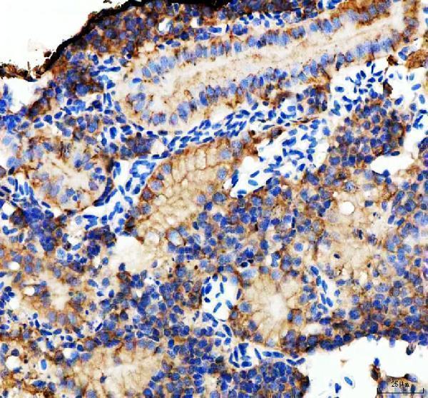 azq90z37 e cadherin cdh1 primary antibodies ihc testing 7