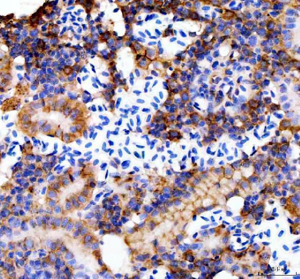 azq90z37 e cadherin cdh1 primary antibodies ihc testing 8