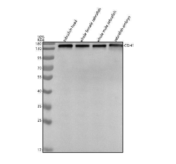  Western blot analysis of E-cadherin/CDH1 using anti-E-cadherin/CDH1 antibody (AZQ90Z37)
