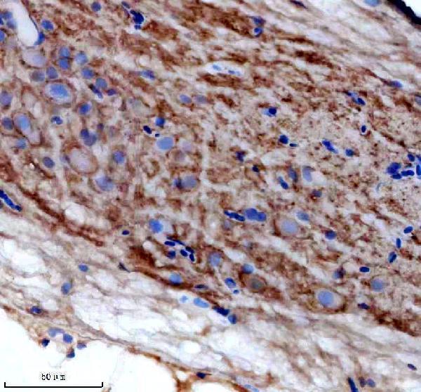 IHC analysis of BCL2L1 using anti-BCL2L1 antibody (AZQ90Z98)