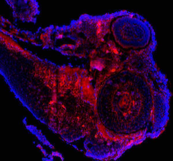 IF analysis of CASK using anti-CASK antibody (AZQ910A4)