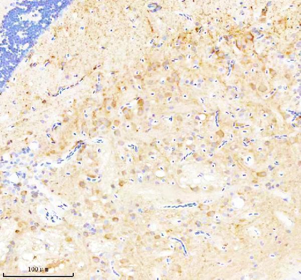  IHC analysis of CASK using anti-CASK antibody (AZQ910A4)
