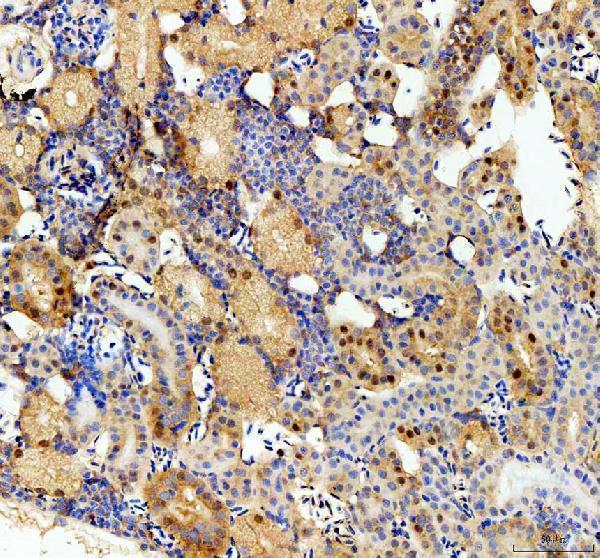  IHC analysis of CSNK2B using anti-CSNK2B antibody (AZQ91398)