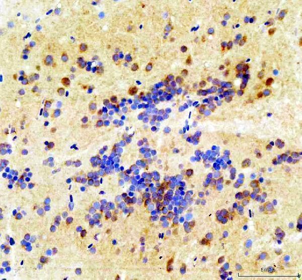  IHC analysis of CSNK2B using anti-CSNK2B antibody (AZQ91398)