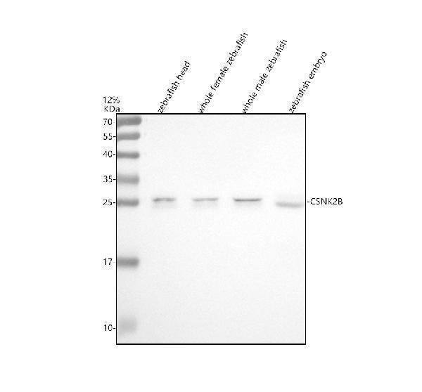  Western blot analysis of CSNK2B using anti-CSNK2B antibody (AZQ91398)