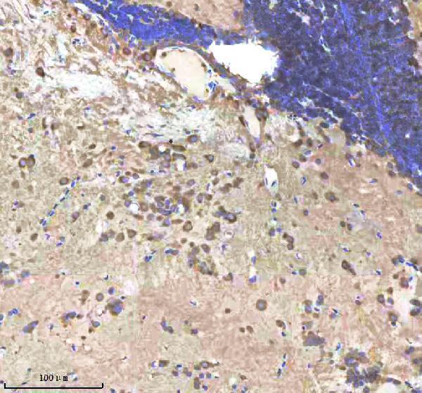 azq92008 shha primary antibodies ihc testing 2