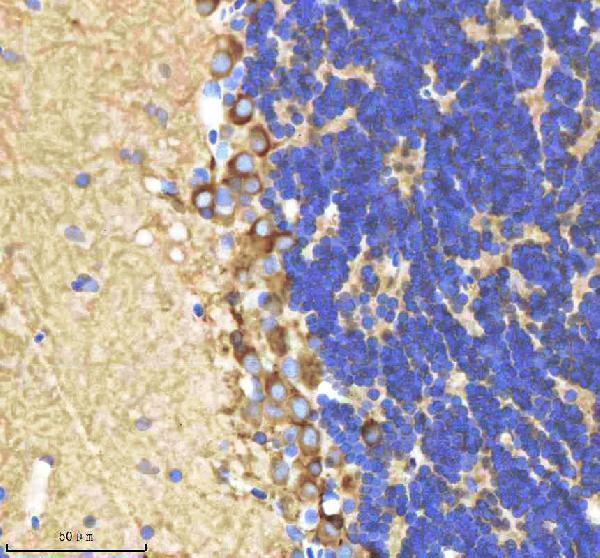 azq92008 shha primary antibodies ihc testing 3