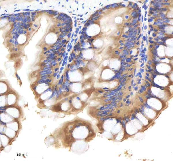 azq92008 shha primary antibodies ihc testing 5
