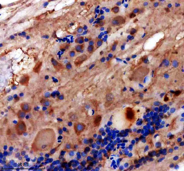 azq98tx4 nkx2 1 primary antibodies ihc testing 1