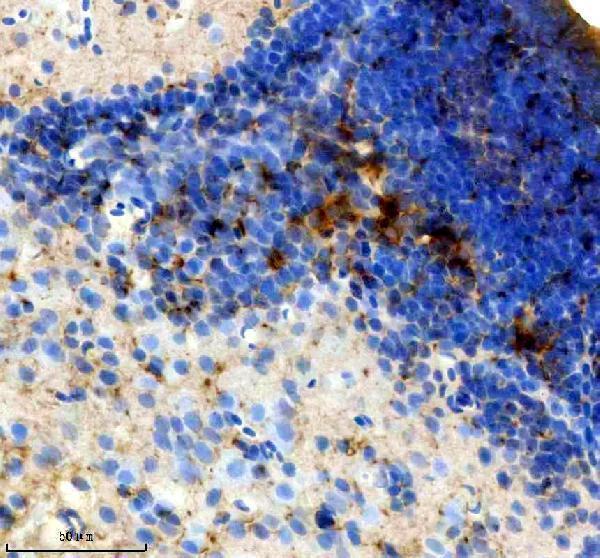 azq9dde4 sst2 primary antibodies ihc testing 1