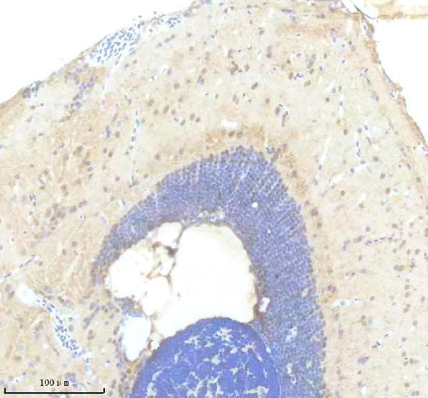 azq9de25 foxc1a primary antibodies ihc testing 1