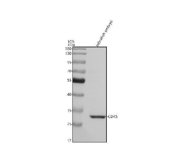  Western blot analysis of CDK5 using anti-CDK5 antibody (AZQ9DE44)