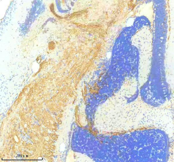 azq9de49 pdgfra primary antibodies ihc testing 1