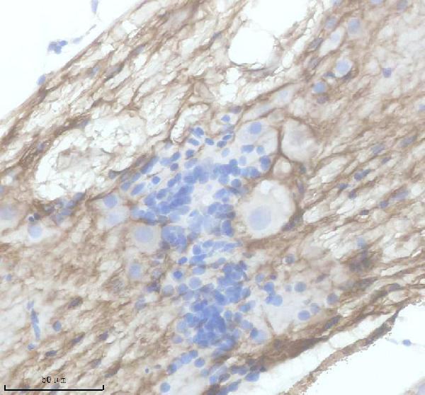 azq9de49 pdgfra primary antibodies ihc testing 2