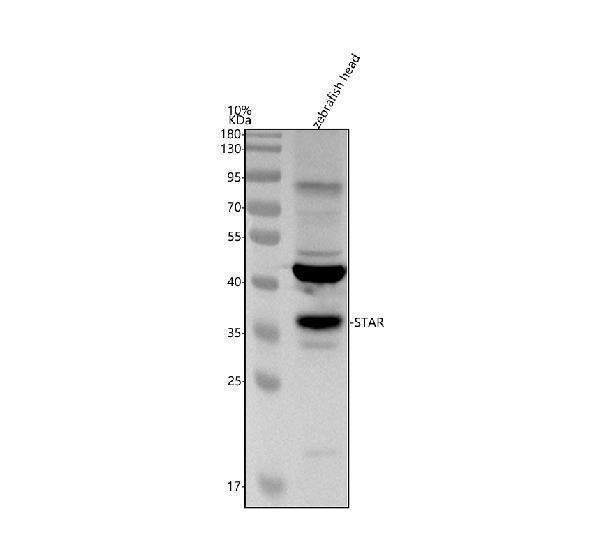  Western blot analysis of STAR using anti-STAR antibody (AZQ9DG10)