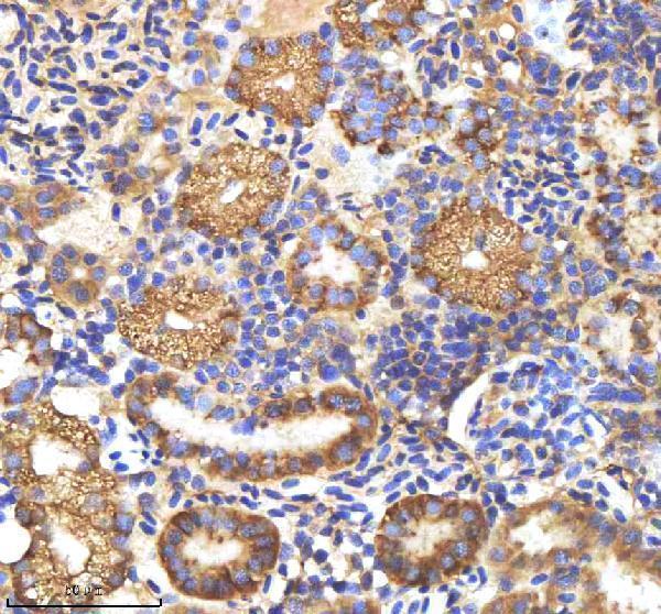  IHC analysis of M-CSFR/CSF1R using anti-M-CSFR/CSF1R antibody (AZQ9I8N6)