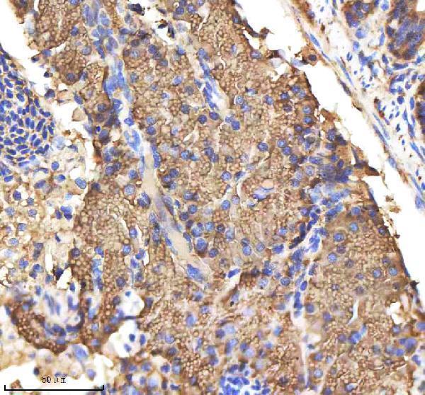  IHC analysis of M-CSFR/CSF1R using anti-M-CSFR/CSF1R antibody (AZQ9I8N6)