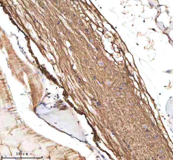  IHC analysis of M-CSFR/CSF1R using anti-M-CSFR/CSF1R antibody (AZQ9I8N6)
