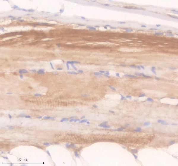 IHC analysis of APAF1 using anti-APAF1 antibody (AZQ9I9H8)