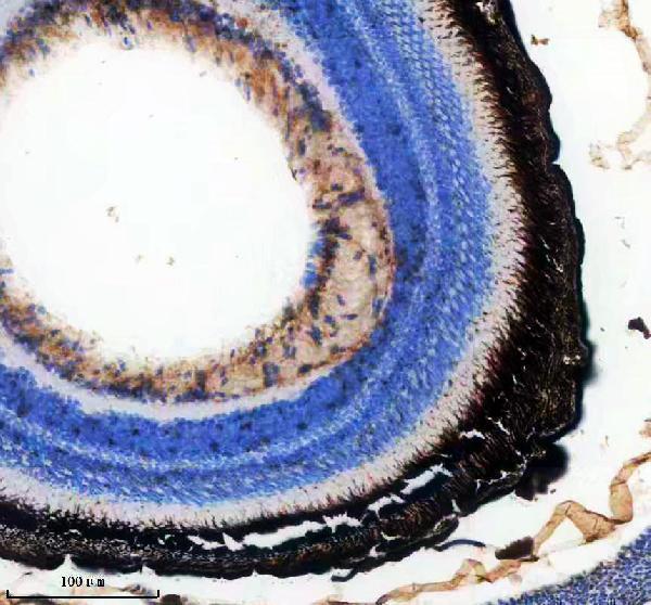 IHC analysis of ASC/TMS1/PYCARD using anti-ASC/TMS1/PYCARD antibody (AZQ9I9N6)