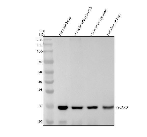 Western blot analysis of ASC/TMS1/PYCARD using anti-ASC/TMS1/PYCARD antibody (AZQ9I9N6)