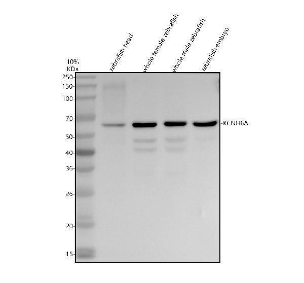 Western blot analysis of Catalase/CAT using anti-Catalase/CAT antibody (AZQ9PT92)