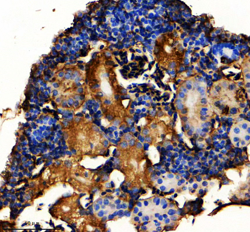 azq9pt95 rbp4 primary antibodies ihc testing 2