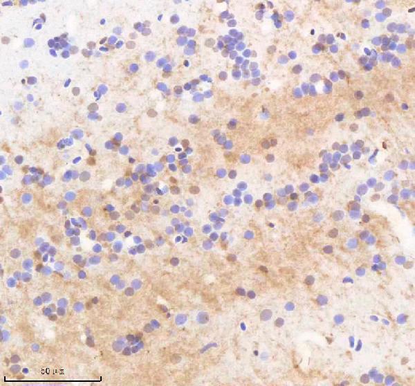 azq9pte3 twist1a 1b 2 primary antibodies ihc testing 1