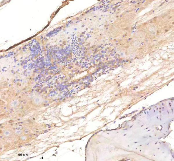 azq9pte3 twist1a 1b 2 primary antibodies ihc testing 2