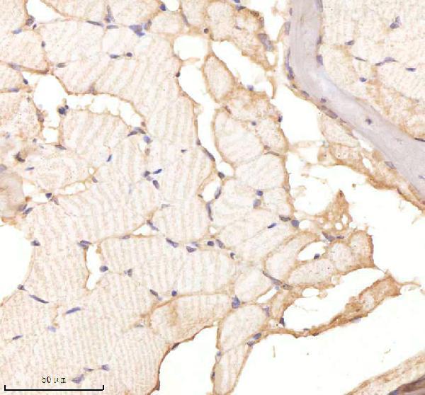 azq9pte3 twist1a 1b 2 primary antibodies ihc testing 3