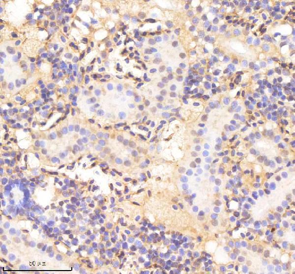 azq9pte3 twist1a 1b 2 primary antibodies ihc testing 4