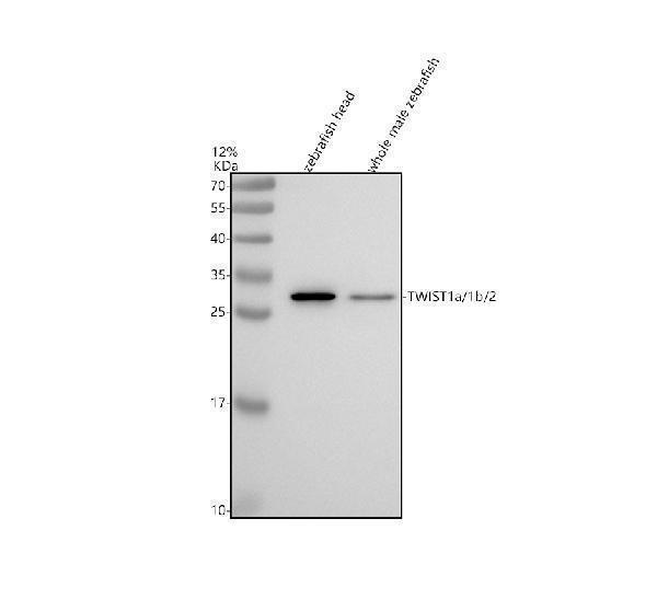azq9pte3 twist1a 1b 2 primary antibodies wb testing 1